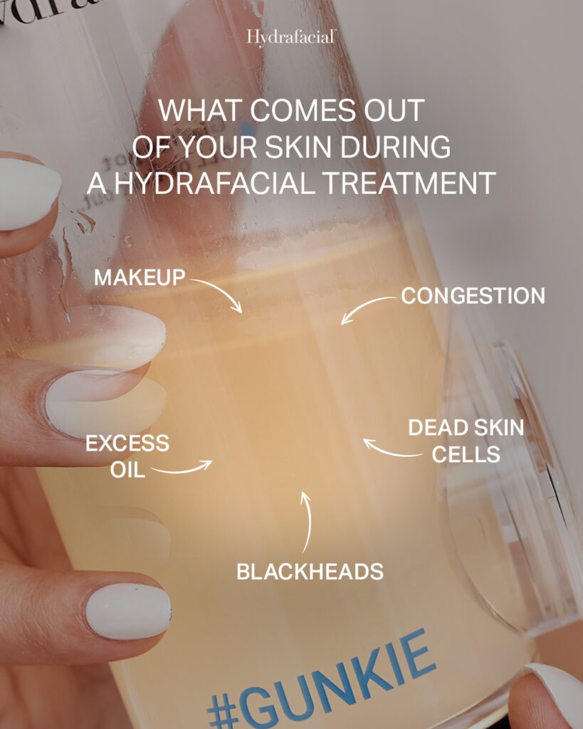 Hydrafacial